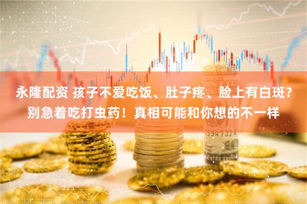 永隆配资 孩子不爱吃饭、肚子疼、脸上有白斑？别急着吃打虫药！真相可能和你想的不一样